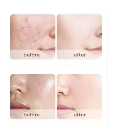 Conceler Facial corrector 01 - Buy Online on GoSupps.com