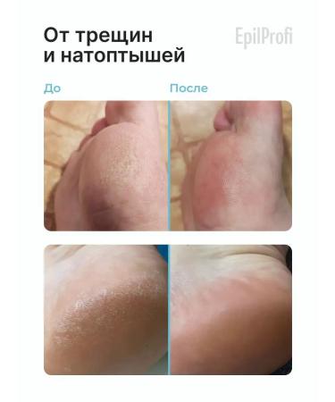 EpilProfi Legs with urea and vitamins from cracks - Buy Online on GoSupps.com