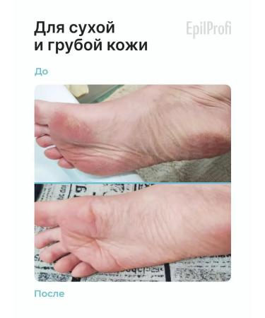 EpilProfi Legs with urea and vitamins from cracks - Buy Online on GoSupps.com