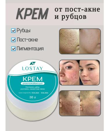LOSTAY Cream from scars post -acne
