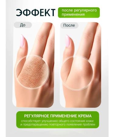 Med Enlim Ointment King of the skin from acne and fungus 1pc - Buy Online on GoSupps.com