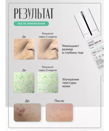 AXIS YSerum Reedle Shot + Axis-y Combo with microeles - Buy Online on GoSupps.com