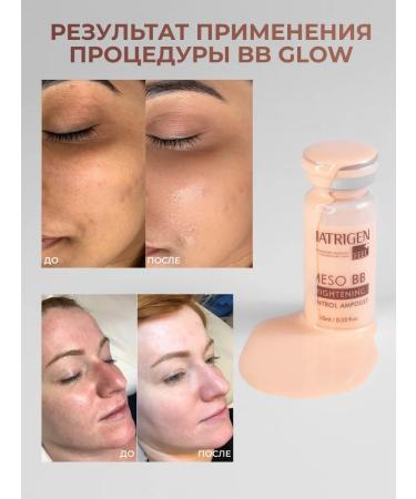 Matrigen Wheezero for the face. Tinting. BB Glow. Korea 1pc - Buy Online on GoSupps.com