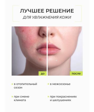 consly Face toner rejuvenating moisturizer with Korea shimmer - Buy Online on GoSupps.com