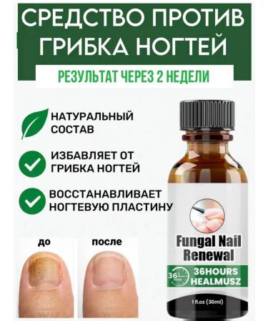 cream Chinese remedy for nail fungus 30 ml