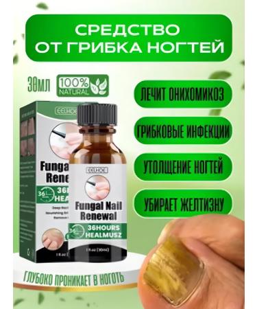 cream Chinese remedy for nail fungus 30 ml - Buy Online on GoSupps.com