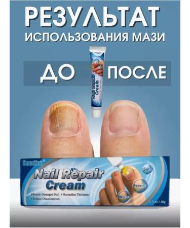 KAVEL Cream from nail fungus on the hand and legs antifungal - Buy Online on GoSupps.com