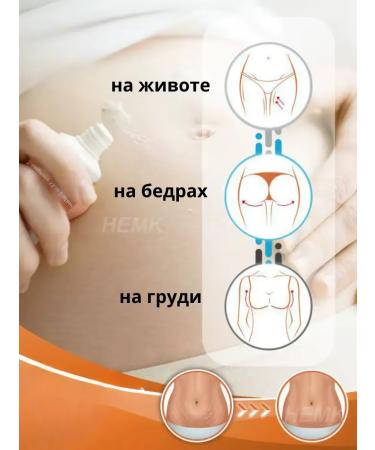 Milleks Cream from stretch marks and scars during pregnancy on the stomach of the chest - Buy Online on GoSupps.com
