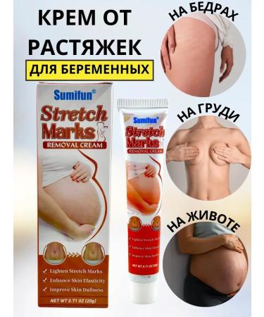 Birthday present Pregnant stretch marks