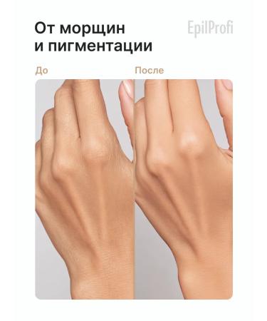 EpilProfi Hand paraffin dry skin cream - Buy Online on GoSupps.com