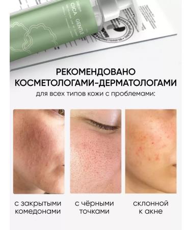 Washing gel moisturizing from acne and acne - Buy Online on GoSupps.com