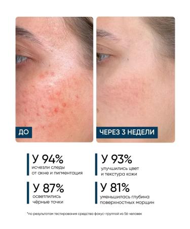 Acidly polishing piling of a face serum - Buy Online on GoSupps.com