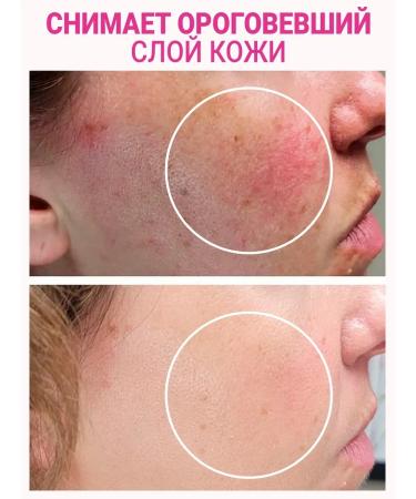 Moisturizing face peeling - Buy Online on GoSupps.com