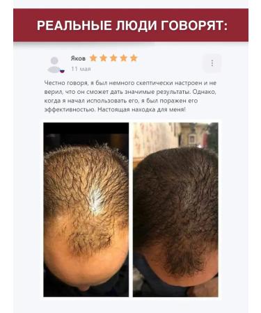 Hair shampoo and serum with red pepper - Buy Online on GoSupps.com