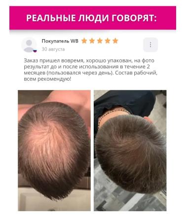 Shampoo from lifting hair with aminexil Aminexil - Buy Online on GoSupps.com