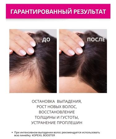 Shampoo from lifting hair with aminexil Aminexil - Buy Online on GoSupps.com