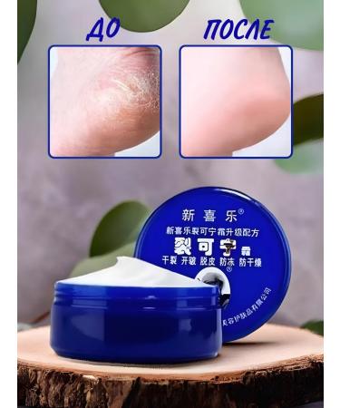 CINDYNAL Hands for arms legs and heels healing - Buy Online on GoSupps.com