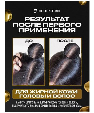 Shampoo for oily scalp 230ml - Buy Online on GoSupps.com