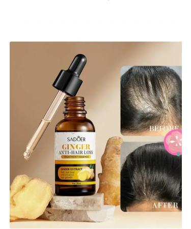 funf Hair loss Ginger Anti