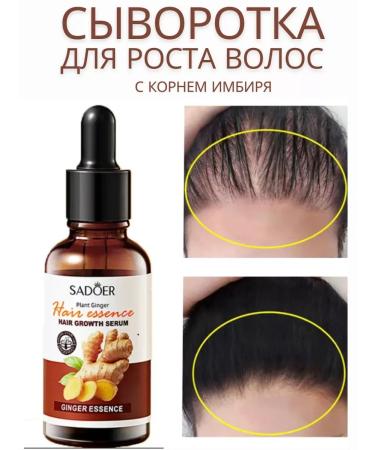 Hair growth with ginger extract