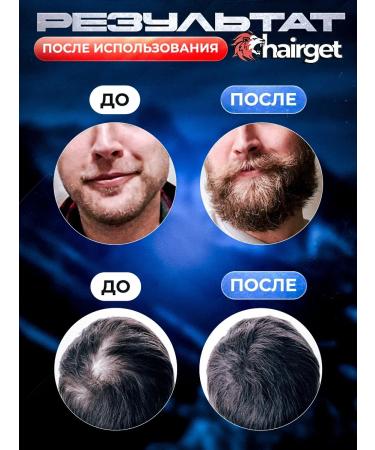 Booster for hair growth and beard 15% - Buy Online on GoSupps.com