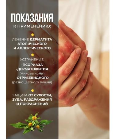 Kartalin Cream from psoriasis and dermatitis ointment from diseases set of 2pcs - Buy Online on GoSupps.com