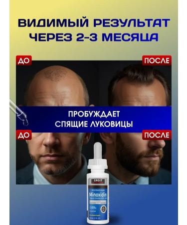 Lotion 16% for hair growth and beard - Buy Online on GoSupps.com