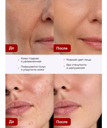 Retinol Anti-Wrinkle Serum - Buy Online on GoSupps.com