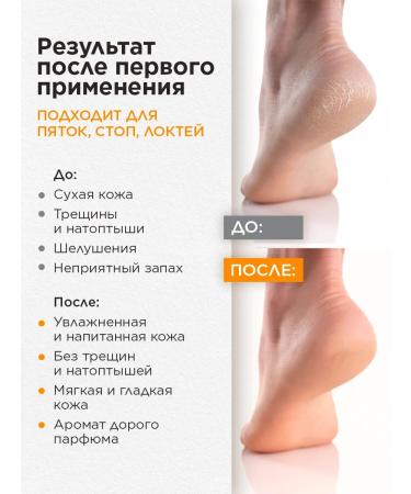 Aromance Foot cream 300 ml Los Cherry - Buy Online on GoSupps.com