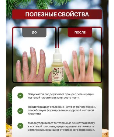 U-way Gum red oil from nail fungus and skin 15 ml - Buy Online on GoSupps.com