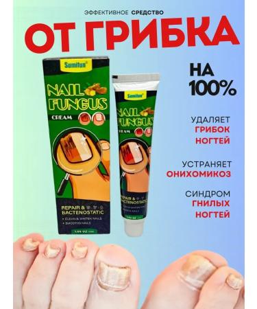 Nail fungus cream and smell