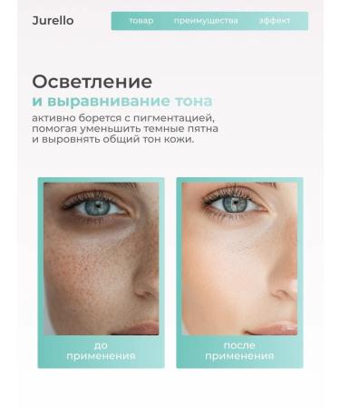 Jurello Whitening cream for face and body - Buy Online on GoSupps.com