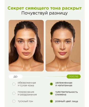 MIXIT Moisturizing face tonic with coconut water - Buy Online on GoSupps.com