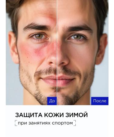 Moisturizing serum for the face of the eyes of Korea Best reviews - Buy Online on GoSupps.com