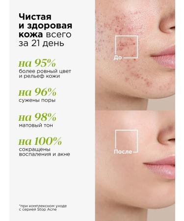 MIXIT Acid tonic for problem skin - Buy Online on GoSupps.com