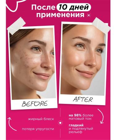 MIXIT Mask with acids for problem skin Stop Acne Face Mask - Buy Online on GoSupps.com