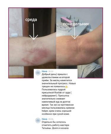 ROSILAK Penalting powder peeling and antibacterial lotion - Buy Online on GoSupps.com