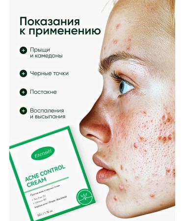 Etens l for you Facial cream for acne with salicylic acid - Buy Online on GoSupps.com