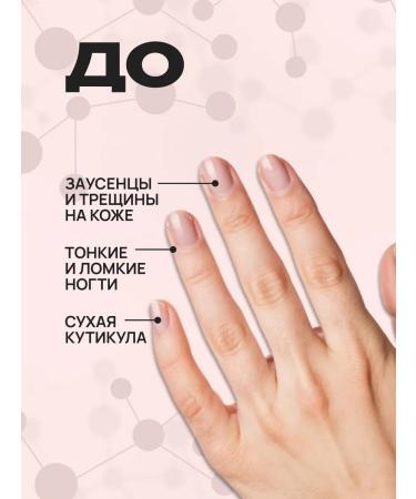 AYA Nail oil and cuticles cherries - Buy Online on GoSupps.com