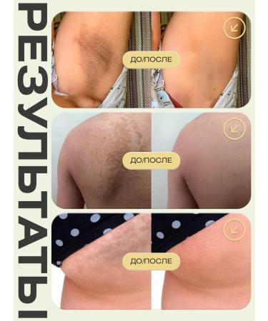 VIS MEDICUS PHARM Whitening face cream from pigmentation - Buy Online on GoSupps.com