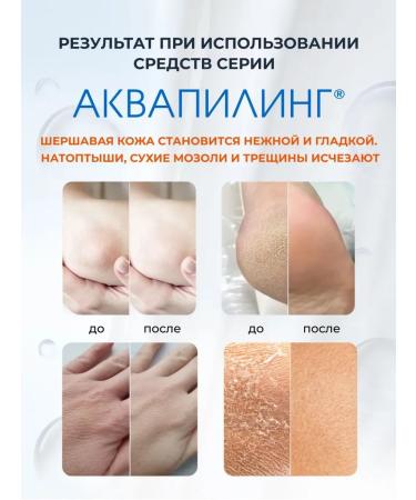 AQUAPEELING Cream-Vosk from cracks - Buy Online on GoSupps.com