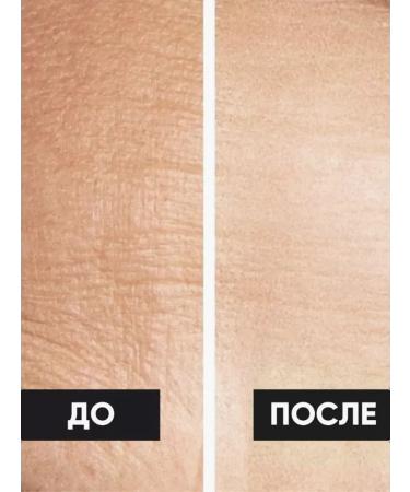 EPICAPROFESSIONAL Nourishing hand cream with vitamin E 250ml - Buy Online on GoSupps.com