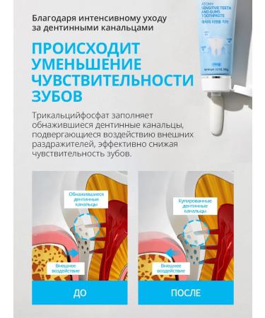 Toothpaste for sensitive teeth 100 grams atomi - Buy Online on GoSupps.com