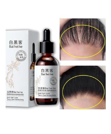 LYDIMOON Hair loss serum activator for growth 60 ml - Buy Online on GoSupps.com