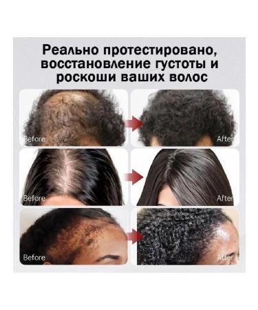 LYDIMOON Hair loss serum activator for growth 60 ml - Buy Online on GoSupps.com