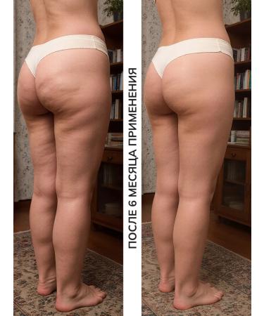 Nuit de Lune A set of wraps for weight loss anti -cellulite - Buy Online on GoSupps.com