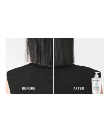 Kerastase Bain Puret Anti-Pelliculaire shampoo - Buy Online on GoSupps.com