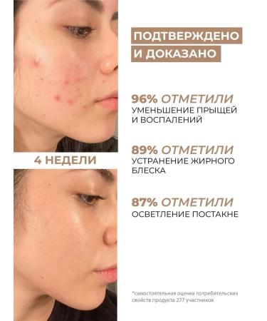 Nonpareil Facial serum cream from acne and acne - Buy Online on GoSupps.com