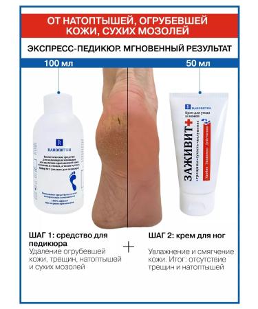 NANO-HEELS Foot set from cracks