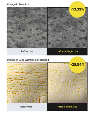 Retinol for the face from wrinkles - Buy Online on GoSupps.com